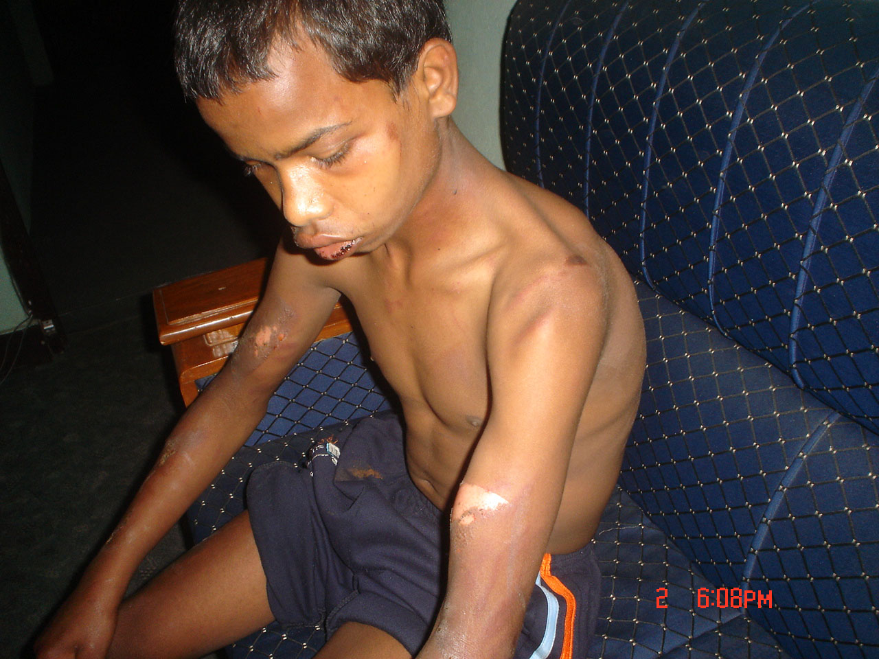 Illegal Child Labor Affects Millions in Nepal